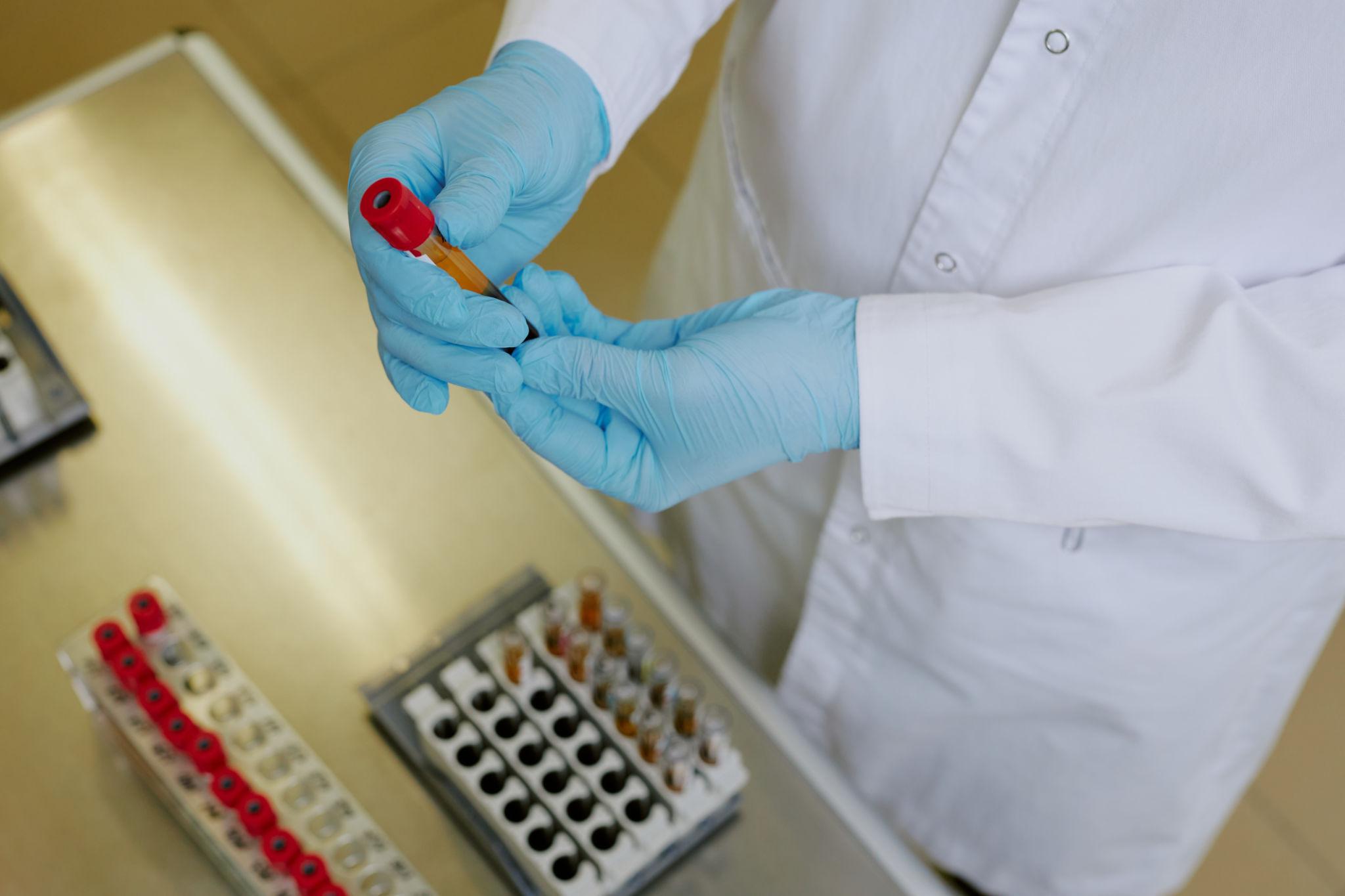 Imagen referencial de Laboratorio Clínico